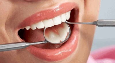 Профессиональные гигиенические мероприятия начинаются с выявления стоматологических проблем